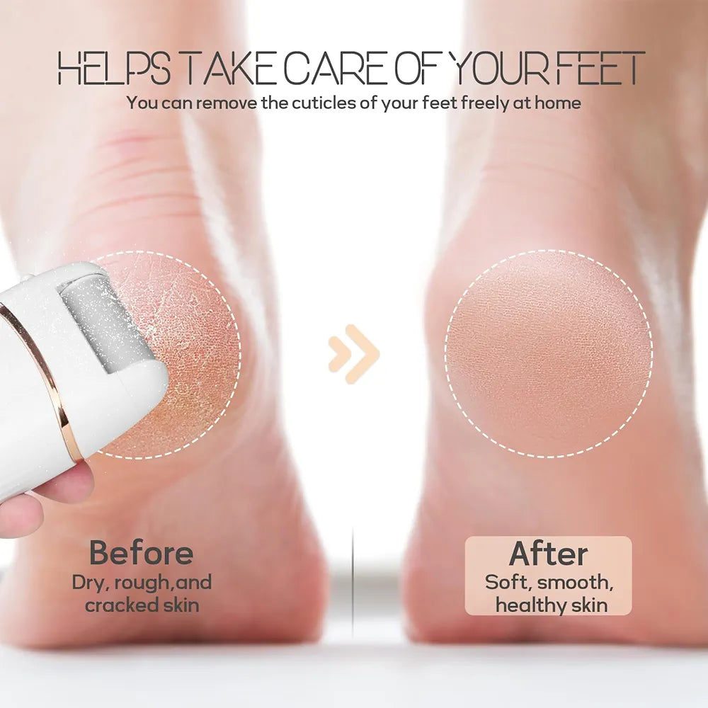 Rechargeable Foot Callus Remover – Pedicure Tool File for Dead, Hard, Cracked, Dry Skin